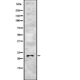 KCNMB4 Antibody - Western blot analysis of MaxiKBeta using HT29 whole cells lysates