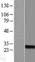KCNMB4 Protein - Western validation with an anti-DDK antibody * L: Control HEK293 lysate R: Over-expression lysate