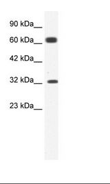 KCNN1 Antibody - KCNN1 antibody (1.25ug/ml) western blot of Jurkat Cell Lysate.  This image was taken for the unconjugated form of this product. Other forms have not been tested.