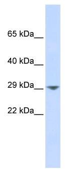 KCNN2 Antibody - Lane: Fetal Muscle Lysate.  This image was taken for the unconjugated form of this product. Other forms have not been tested.