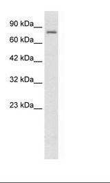 KCNN3 / SK3 Antibody - Daudi Cell Lysate.  This image was taken for the unconjugated form of this product. Other forms have not been tested.