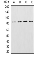 KCNN3 / SK3 Antibody - Western blot analysis of KCNN3 expression in Raji (A); mouse heart (B); mouse liver (C); rat brain (D) whole cell lysates.