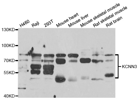 KCNN3 / SK3 Antibody - Western blot analysis of extracts of various cell lines, using KCNN3 antibody at 1:1000 dilution. The secondary antibody used was an HRP Goat Anti-Rabbit IgG (H+L) at 1:10000 dilution. Lysates were loaded 25ug per lane and 3% nonfat dry milk in TBST was used for blocking. An ECL Kit was used for detection and the exposure time was 60s.