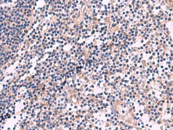 KCNN3 / SK3 Antibody - Immunohistochemistry of paraffin-embedded Human tonsil tissue  using KCNN3 Polyclonal Antibody at dilution of 1:60(×200)