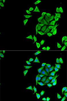 KCNN3 / SK3 Antibody - Immunofluorescence analysis of U2OS cells using KCNN3 Polyclonal Antibody.