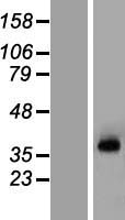 KCNN3 / SK3 Protein - Western validation with an anti-DDK antibody * L: Control HEK293 lysate R: Over-expression lysate