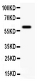 KCNN4 / KCa3.1 Antibody - Anti-KCNN antibody, Western blotting All lanes: Anti KCNN at 0.5ug/mlWB: HUT Whole Cell Lysate at 40ugPredicted bind size: 60KD Observed bind size: 60KD