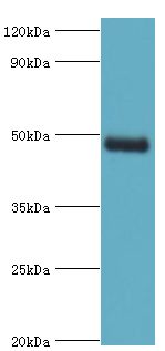 KCNN4 / KCa3.1 Antibody - Western blot. All lanes: Intermediate conductance calcium-activated potassium channel protein 4 antibody at 8 ug/ml+human serum. Secondary antibody: Goat polyclonal to rabbit at 1:10000 dilution. Predicted band size: 48 kDa. Observed band size: 48 kDa.