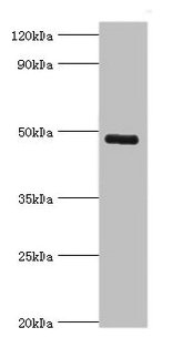 KCNN4 / KCa3.1 Antibody - Western blot All lanes: KCNN4 antibody at 8µg/ml + human serum Secondary Goat polyclonal to rabbit IgG at 1/10000 dilution Predicted band size: 48 kDa Observed band size: 48 kDa