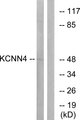 KCNN4 / KCa3.1 Antibody - Western blot analysis of lysates from HepG2 cells, using KCNN4 Antibody. The lane on the right is blocked with the synthesized peptide.
