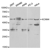 KCNN4 / KCa3.1 Antibody - Western blot analysis of extracts of various cell lines.