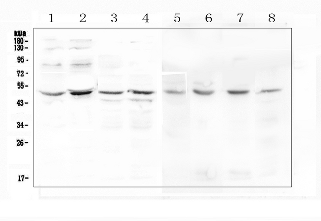 KCNN4 / KCa3.1 Antibody - Western blot analysis of KCNN4 using anti-KCNN4 antibody. Electrophoresis was performed on a 5-20% SDS-PAGE gel at 70V (Stacking gel) / 90V (Resolving gel) for 2-3 hours. The sample well of each lane was loaded with 50ug of sample under reducing conditions. Lane 1: human Caco-2 whole cell lysate,Lane 2: human PC-3 whole cell lysate,Lane 3: human A549 whole cell lysate,Lane 4: human Hela whole cell lysate,Lane 5: rat stomach tissue lysates,Lane 6: rat testis tissue lysates,Lane 7: mouse testis tissue lysates,Lane 8: mouse liver tissue lysates. After Electrophoresis, proteins were transferred to a Nitrocellulose membrane at 150mA for 50-90 minutes. Blocked the membrane with 5% Non-fat Milk/ TBS for 1.5 hour at RT. The membrane was incubated with rabbit anti-KCNN4 antigen affinity purified polyclonal antibody at 0.5 µg/mL overnight at 4°C, then washed with TBS-0.1% Tween 3 times with 5 minutes each and probed with a goat anti-rabbit IgG-HRP secondary antibody at a dilution of 1:10000 for 1.5 hour at RT. The signal is developed using an Enhanced Chemiluminescent detection (ECL) kit with Tanon 5200 system. A specific band was detected for KCNN4 at approximately 48KD. The expected band size for KCNN4 is at 48KD.
