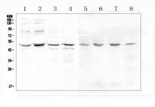KCNN4 / KCa3.1 Antibody - Western blot analysis of KCNN4 using anti-KCNN4 antibody. Electrophoresis was performed on a 5-20% SDS-PAGE gel at 70V (Stacking gel) / 90V (Resolving gel) for 2-3 hours. The sample well of each lane was loaded with 50ug of sample under reducing conditions. Lane 1: human Caco-2 whole cell lysate,Lane 2: human PC-3 whole cell lysate,Lane 3: human A549 whole cell lysate,Lane 4: human Hela whole cell lysate,Lane 5: rat stomach tissue lysates,Lane 6: rat testis tissue lysates,Lane 7: mouse testis tissue lysates,Lane 8: mouse liver tissue lysates. After Electrophoresis, proteins were transferred to a Nitrocellulose membrane at 150mA for 50-90 minutes. Blocked the membrane with 5% Non-fat Milk/ TBS for 1.5 hour at RT. The membrane was incubated with rabbit anti-KCNN4 antigen affinity purified polyclonal antibody at 0.5 µg/mL overnight at 4°C, then washed with TBS-0.1% Tween 3 times with 5 minutes each and probed with a goat anti-rabbit IgG-HRP secondary antibody at a dilution of 1:10000 for 1.5 hour at RT. The signal is developed using an Enhanced Chemiluminescent detection (ECL) kit with Tanon 5200 system. A specific band was detected for KCNN4 at approximately 48KD. The expected band size for KCNN4 is at 48KD.