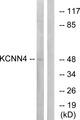 KCNN4 / KCa3.1 Antibody - Western blot analysis of extracts from HepG2 cells, using KCNN4 antibody.