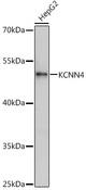 KCNN4 / KCa3.1 Antibody - Western blot analysis of extracts of HepG2 cells using KCNN4 Polyclonal Antibody at dilution of 1:1000.
