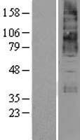 KCNN4 / KCa3.1 Protein - Western validation with an anti-DDK antibody * L: Control HEK293 lysate R: Over-expression lysate