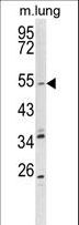 KCNQ1 / KVLQT1 Antibody - Western blot of KCNQ1 Antibody in mouse lung tissue lysates (35 ug/lane). KCNQ1 (arrow) was detected using the purified antibody.