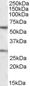 KCNQ1 / KVLQT1 Antibody - KCNQ1 antibody (1 ug/ml) staining of Human Heart lysate (35 ug protein/ml in RIPA buffer). Primary incubation was 1 hour. Detected by chemiluminescence.