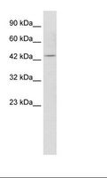 KCNQ1 / KVLQT1 Antibody - Jurkat Cell Lysate.  This image was taken for the unconjugated form of this product. Other forms have not been tested.
