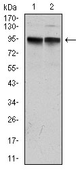 KCNQ1 / KVLQT1 Antibody - Western blot using KCNQ1 mouse monoclonal antibody against MCF-7 (1) and A431 (2) cell lysate.