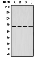 KCNQ1 / KVLQT1 Antibody - Western blot analysis of Kv7.1 expression in MCF7 (A); A431 (B); mouse brain (C); rat brain (D) whole cell lysates.