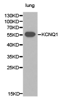 KCNQ1 / KVLQT1 Antibody - Western blot of extracts of lung cell lines, using KCNQ1 antibody.