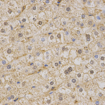 KCNQ1 / KVLQT1 Antibody - Immunohistochemistry of paraffin-embedded human liver using KCNQ1 antibody at dilution of 1:200 (x400 lens)