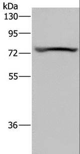 KCNQ1 / KVLQT1 Antibody - Western blot analysis of Mouse heart tissue, using KCNQ1 Polyclonal Antibody at dilution of 1:200.
