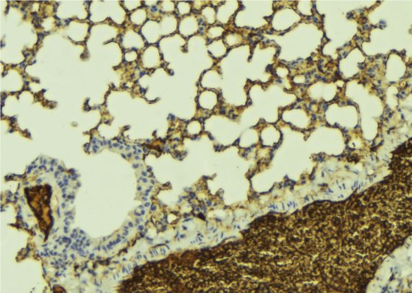 KCNQ1 / KVLQT1 Antibody - 1:100 staining mouse lung tissue by IHC-P. The sample was formaldehyde fixed and a heat mediated antigen retrieval step in citrate buffer was performed. The sample was then blocked and incubated with the antibody for 1.5 hours at 22°C. An HRP conjugated goat anti-rabbit antibody was used as the secondary.