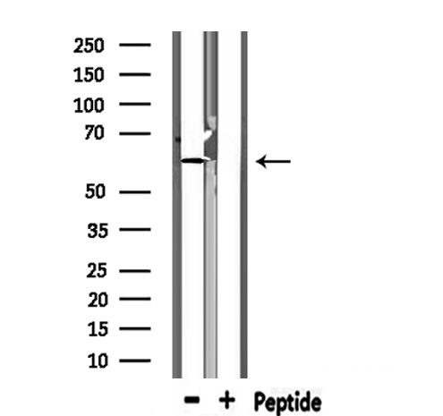 KCNQ1 / KVLQT1 Antibody - Western blot analysis of extracts of mouse muscle using KCNQ1 antibody.