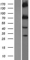 KCNQ1 / KVLQT1 Protein - Western validation with an anti-DDK antibody * L: Control HEK293 lysate R: Over-expression lysate