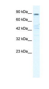 KCNQ2 Antibody - KCNQ2 antibody Western blot of HepG2 cell lysate. This image was taken for the unconjugated form of this product. Other forms have not been tested.