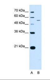 KCNQ2 Antibody - Lane A: Marker. Lane B: Jurkat cell lysate. Antibody concentration: 0.5 ug/ml. Gel concentration: 12%.  This image was taken for the unconjugated form of this product. Other forms have not been tested.