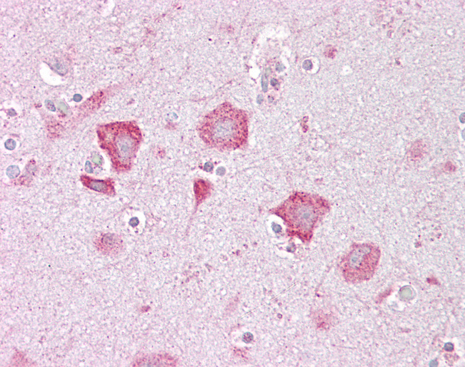 KCNQ2 Antibody - Anti-KCNQ2 antibody IHC of human brain, cortex. Immunohistochemistry of formalin-fixed, paraffin-embedded tissue after heat-induced antigen retrieval. Antibody concentration 5 ug/ml.  This image was taken for the unconjugated form of this product. Other forms have not been tested.