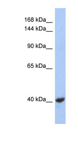 KCNQ2 Antibody - KCNQ2 antibody Western blot of NCI-H226 cell lysate. This image was taken for the unconjugated form of this product. Other forms have not been tested.