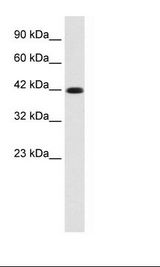 KCNQ2 Antibody - HepG2 Cell Lysate.  This image was taken for the unconjugated form of this product. Other forms have not been tested.