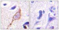 KCNQ2 + KCNQ3 + KCNQ4 + KCNQ5 Antibody - Immunohistochemistry analysis of paraffin-embedded human brain tissue, using Kv7.3/KCNQ3 Antibody. The picture on the right is blocked with the synthesized peptide.