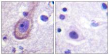 KCNQ3 Antibody - Immunohistochemistry analysis of paraffin-embedded human brain, using Kv7.3/KCNQ3 (Phospho-Thr246) Antibody. The picture on the right is blocked with the phospho peptide.
