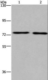 KCNQ4 Antibody - Western blot analysis of Human fetal brain and mouse brain tissue, using KCNQ4 Polyclonal Antibody at dilution of 1:200.