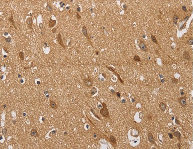 KCNQ4 Antibody - Immunohistochemistry of paraffin-embedded Human brain using KCNQ4 Polyclonal Antibody at dilution of 1:40.