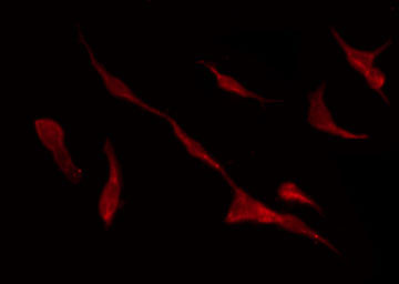 KCNQ4 Antibody - Staining HuvEc cells by IF/ICC. The samples were fixed with PFA and permeabilized in 0.1% Triton X-100, then blocked in 10% serum for 45 min at 25°C. The primary antibody was diluted at 1:200 and incubated with the sample for 1 hour at 37°C. An Alexa Fluor 594 conjugated goat anti-rabbit IgG (H+L) Ab, diluted at 1/600, was used as the secondary antibody.