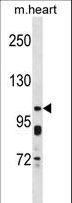 KCNQ5 Antibody - KCNQ5 Antibody western blot of mouse heart tissue lysates (35 ug/lane). The KCNQ5 antibody detected the KCNQ5 protein (arrow).