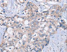 KCNQ5 Antibody - Immunohistochemistry of paraffin-embedded Human brain using KCNQ5 Polyclonal Antibody at dilution of 1:60.