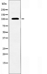 KCNQ5 Antibody - Western blot analysis of extracts of Jurkat cells using KCNQ5 antibody.
