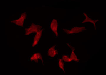 KCNQ5 Antibody - Staining HeLa cells by IF/ICC. The samples were fixed with PFA and permeabilized in 0.1% Triton X-100, then blocked in 10% serum for 45 min at 25°C. The primary antibody was diluted at 1:200 and incubated with the sample for 1 hour at 37°C. An Alexa Fluor 594 conjugated goat anti-rabbit IgG (H+L) Ab, diluted at 1/600, was used as the secondary antibody.