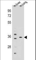 KCNRG Antibody - KCNRG Antibody western blot of mouse liver,lung tissue lysates (35 ug/lane). The KCNRG antibody detected the KCNRG protein (arrow).