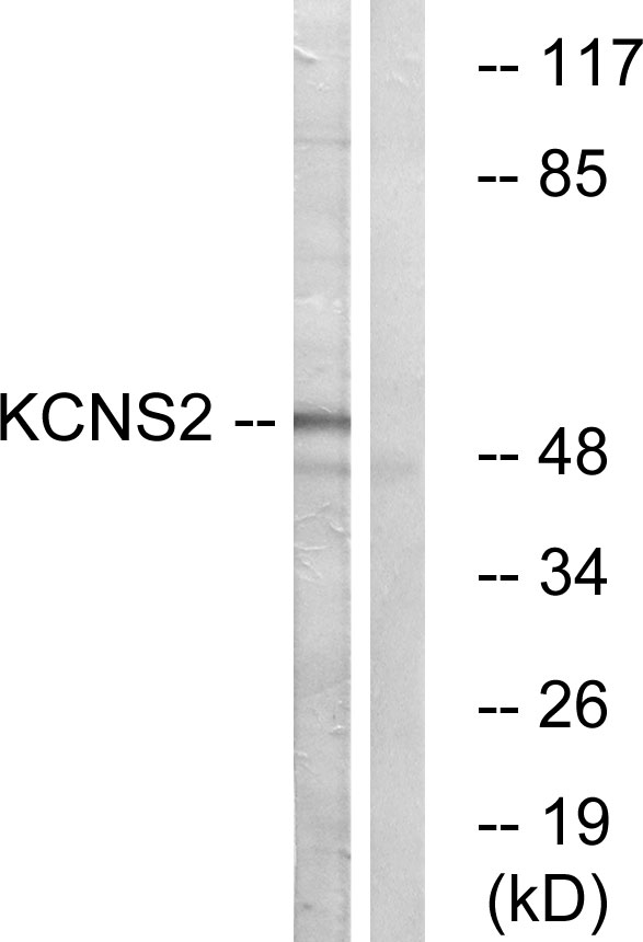 KCNS2 Antibody - Western blot analysis of lysates from HepG2 cells, using KCNS2 Antibody. The lane on the right is blocked with the synthesized peptide.