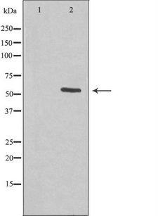 KCNS2 Antibody - Western blot analysis of extracts of HepG2 cells using KCNS2 antibody. The lane on the left is treated with the antigen-specific peptide.