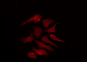 KCNS2 Antibody - Staining HepG2 cells by IF/ICC. The samples were fixed with PFA and permeabilized in 0.1% Triton X-100, then blocked in 10% serum for 45 min at 25°C. The primary antibody was diluted at 1:200 and incubated with the sample for 1 hour at 37°C. An Alexa Fluor 594 conjugated goat anti-rabbit IgG (H+L) Ab, diluted at 1/600, was used as the secondary antibody.