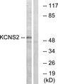 KCNS2 Antibody - Western blot analysis of extracts from HepG2 cells, using KCNS2 antibody.